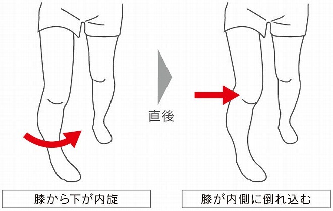 メディカル分野の専門家が 怪我予防 のメソッドを大公開 膝の靭帯損傷編 サッカーダイジェストweb メディカル分野の専門家が 怪我予防 のメソッドを大公開 膝の靭帯損傷編 サッカーダイジェストweb